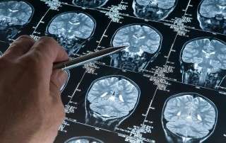 the-latest-in-alzheimers-research-free-class