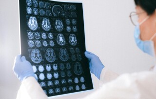 CTE & Other Rare Neurological Disorders